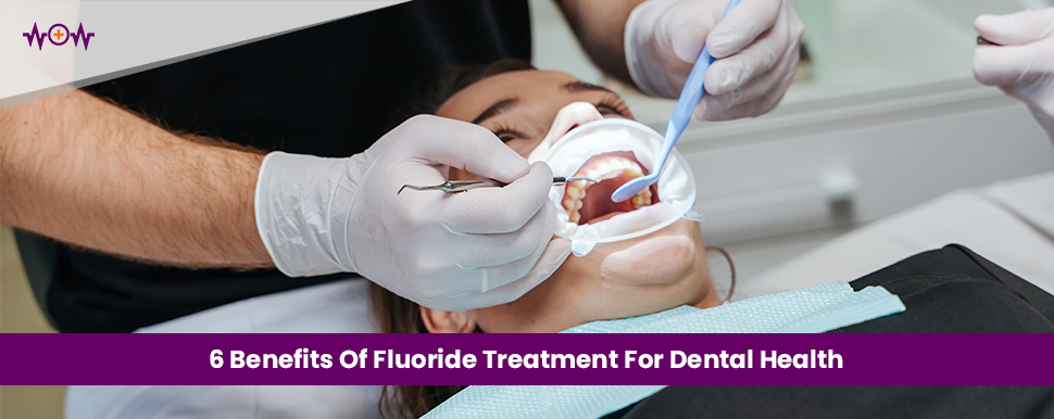 5 Benefits Of Fluoride Treatment For Dental Health