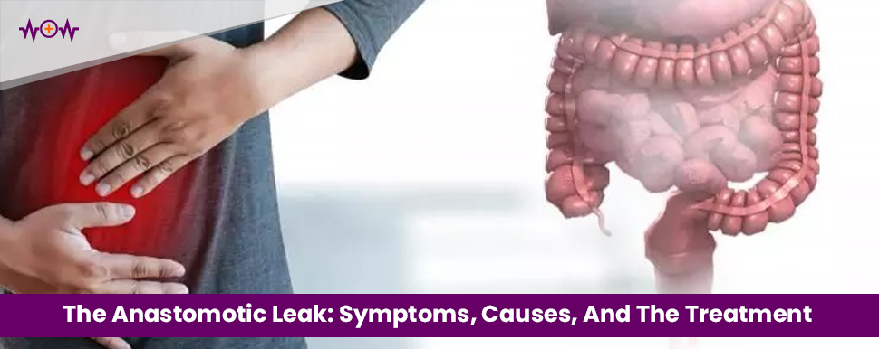 The Anastomotic Leak: Symptoms, Causes, And The Treatment