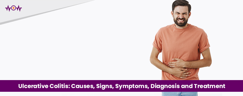 Ulcerative Colitis: Causes, Signs, Symptoms, Diagnosis and Treatment