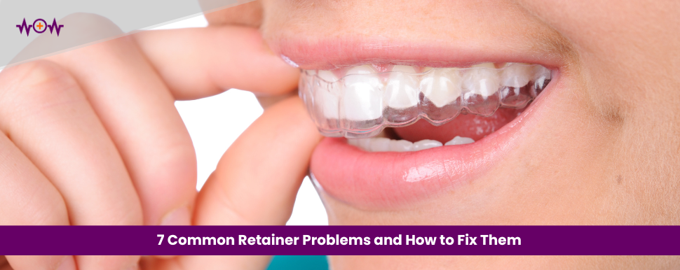 7 Common Retainer Problems and How to Fix Them
