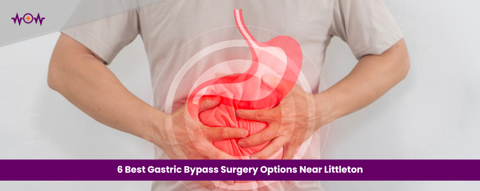6 Best Gastric Bypass Surgery Options Near Littleton
